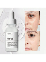 SHEIN KOEC Hyaluronic Acid 2% + B5 Facial Serum ممنوع الفتح H2 - PINK SHOP EG