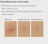 SOME BY MI Retinol Intense Reactivating Serum H5 ممنوع الفتح - PINK SHOP EG