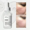 SHEIN KOEC Niacinamide 10% + Zinc 1% Facial Serum 30ml