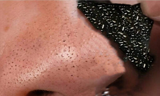 SHEIN 1 pcs Bamboo Charcoal Blackhead Remover Nose - Image 3