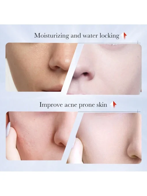 shein Whitening And Anti-Freckle Cream, Spot Removal - Image 5