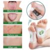 SHEIN 10pcs Deep Cleaning Herbal Foot Pads With Ginger Oil And Bamboo Charcoal For Foot Care