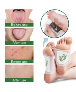 SHEIN 10pcs Deep Cleaning Herbal Foot Pads With Ginger Oil And Bamboo Charcoal For Foot Care