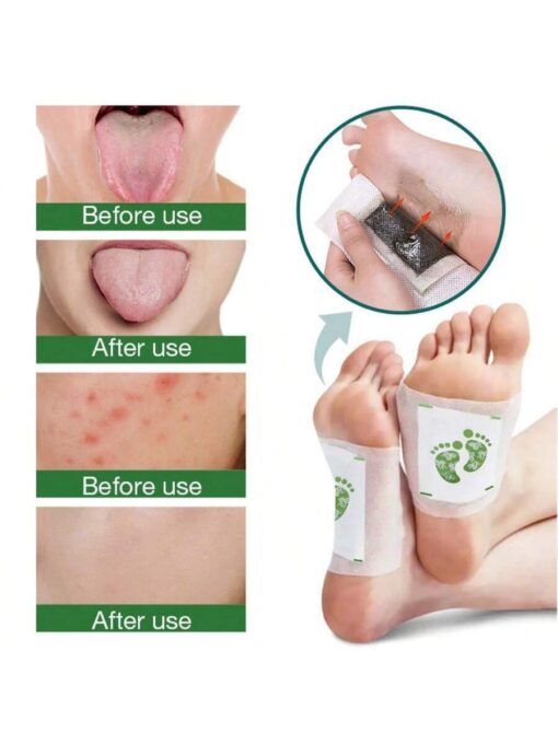 SHEIN 10pcs Deep Cleaning Herbal Foot Pads With Ginger Oil And Bamboo Charcoal For Foot Care